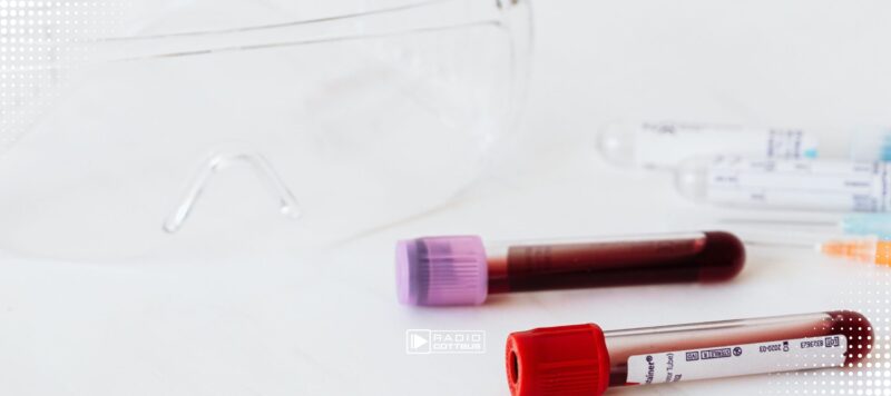 HIV-Neuinfektionen steigen – RKI warnt vor hoher Dunkelziffer in Brandenburg