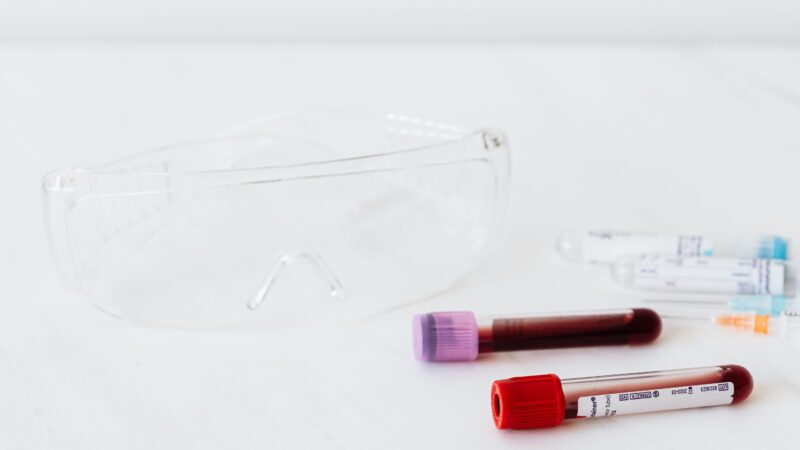 HIV-Neuinfektionen steigen – RKI warnt vor hoher Dunkelziffer in Brandenburg