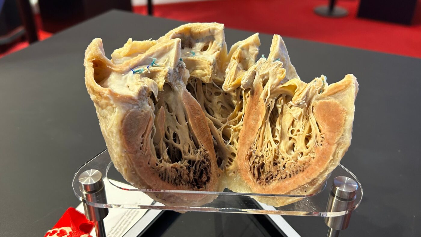Ein plastiniertes Herz aus dem Gubener Plastinarium